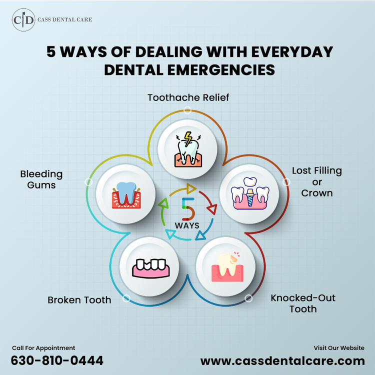 5 Ways of Dealing with Everyday Dental Emergencies